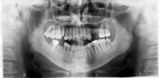 Radiología digital